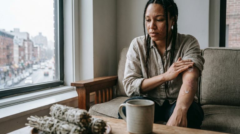 Les maladies de peau dues au stress : causes et solutions